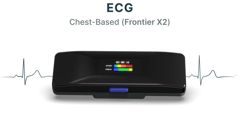 ECG
